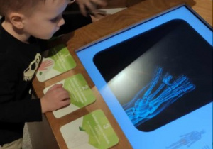 Chłopiec obserwuje swoją rękę na zdjeciu rtg